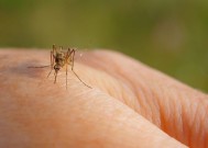 随着英国害虫数量的激增，护士揭示了为什么蚊子叮咬的人比其他人多